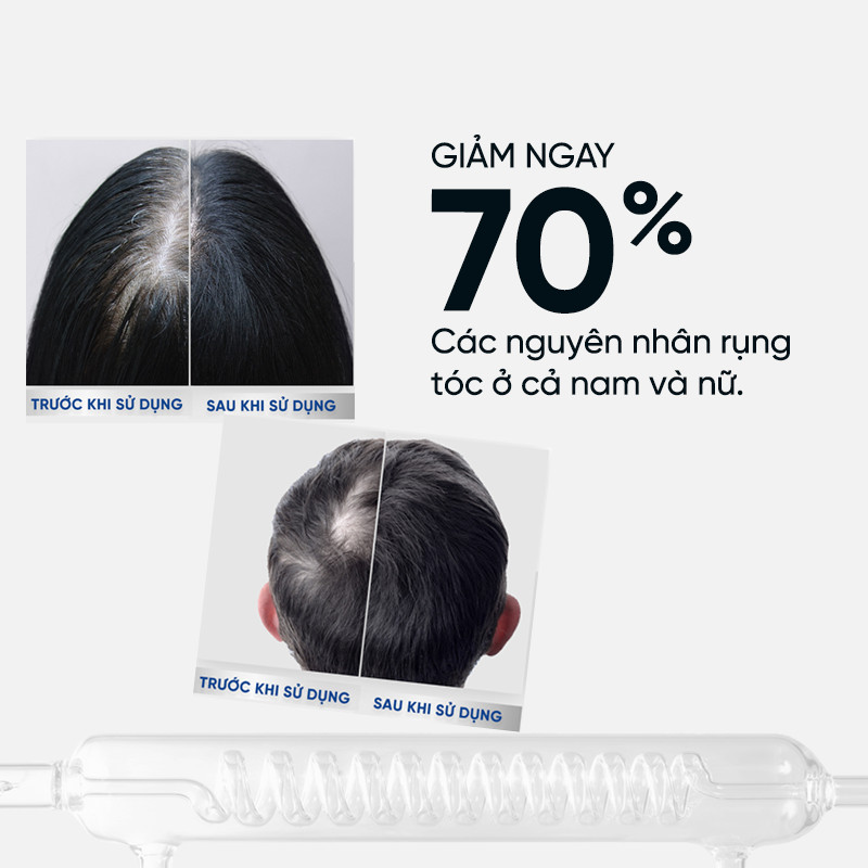 Dầu Gội Novoxidyl Balan. Chai 200ml.